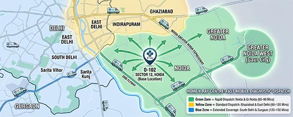 Map showing fast Home X-Ray mobile unit dispatch coverage across Noida and NCR